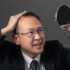 現役医師が語る男性の薄毛のお悩み 解消するには【前編】
