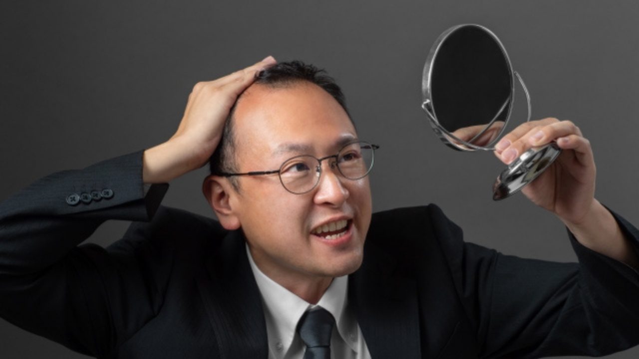 現役医師が語る男性の薄毛のお悩み 解消するには【前編】